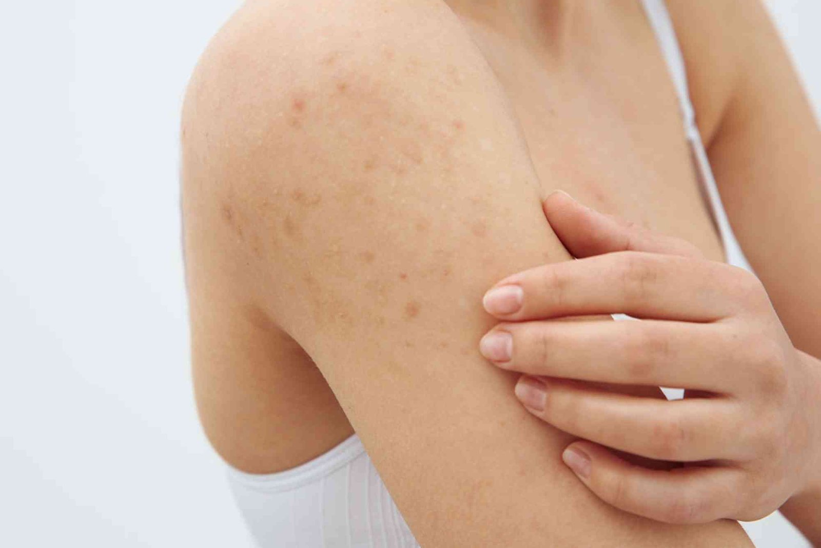 Cara Merawat Kulit Lengan dan Kaki agar Cerah